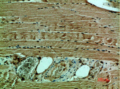 Anti-COL12A1