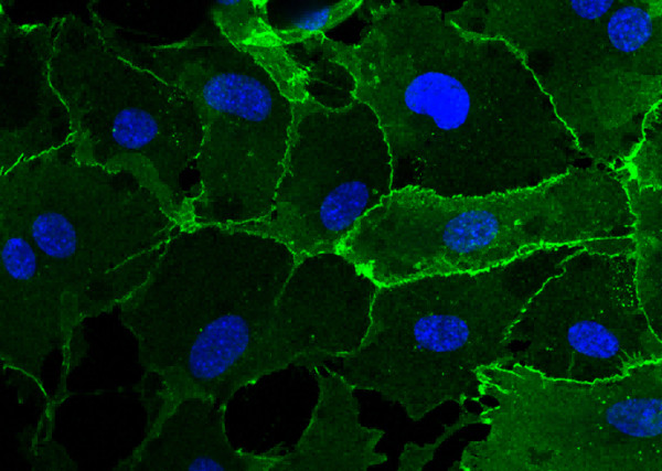 Anti-VE-Cadherin/CD144/CDH5 Monoclonal Recombinant Antibody