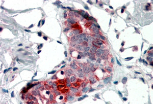 Anti-Mammaglobin A / SCGB2A2, Internal