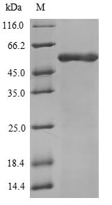 ATP synthase subunit beta, mitochondrial (ATP5F1B), human, recombinant