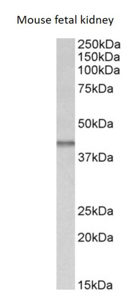 Anti-IDH5B