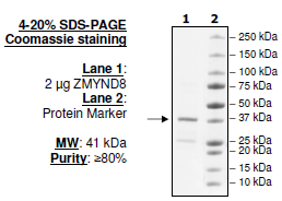 ZMYND8 (160 - 280), GST-tag, human recombinant protein