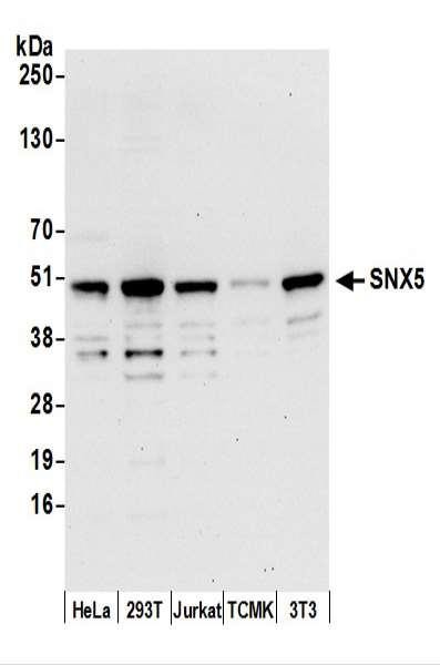 Anti-SNX5