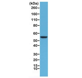 Anti-Cytokeratin 8 / KRT8, clone RM266 (recombinant antibody)