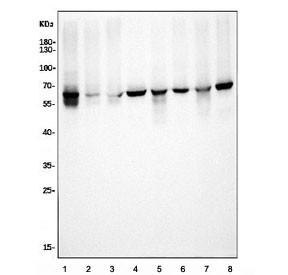 Anti-Elongator complex protein 3 / ELP3 / KAT9, clone 8B4