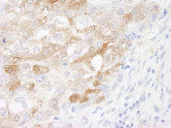 Anti-CRABP2 (IHC)