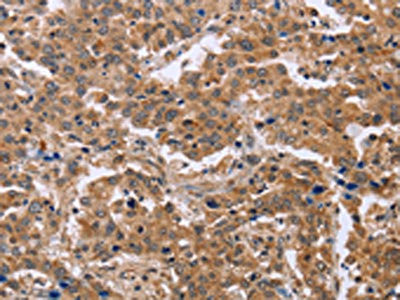 Anti-EPDR1