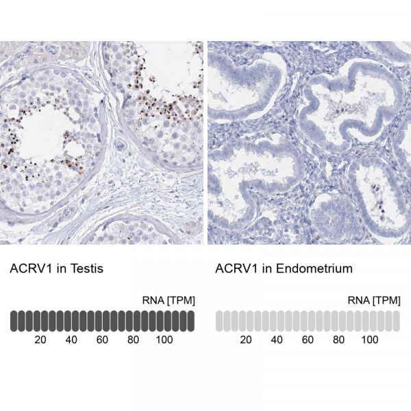 Anti-ACRV1