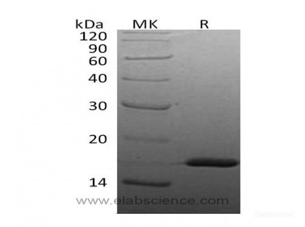 Interleukin-1ß/IL-1ß Protein (recombinant human)