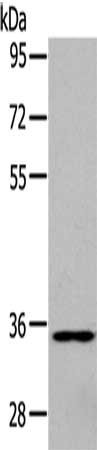 Anti-GJD2