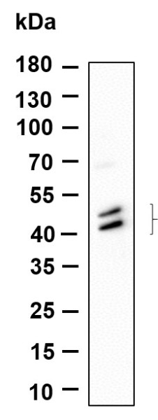Anti-Recombinant Phospho-Jun, JunD (Ser73, Ser100), clone 6H8