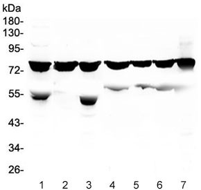 Anti-PKC beta 1 / PRKCB1