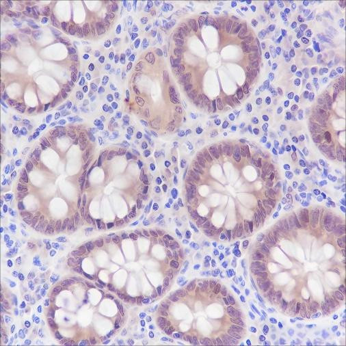 Anti-Recombinant SETBP1, clone A359