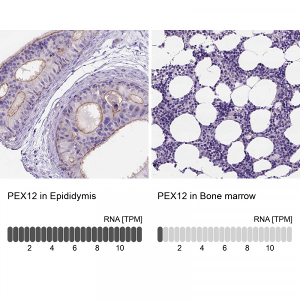 Anti-PEX12
