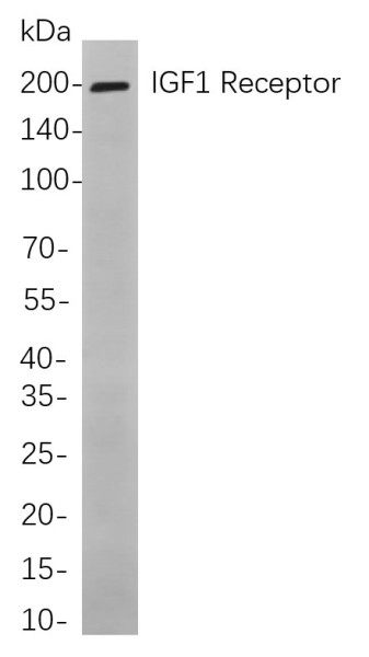 Anti-Recombinant IGF1 Receptor, clone 6A5