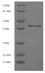 Ankyrin repeat and SOCS box protein 6 (ASB6), human, recombinant