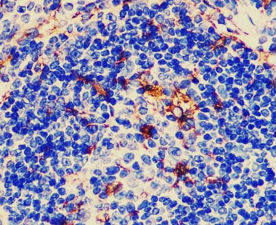 Anti-CD86