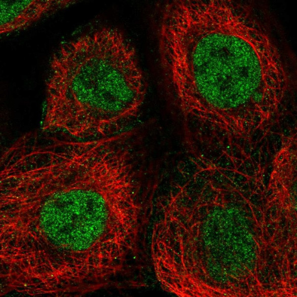 Anti-ERCC4