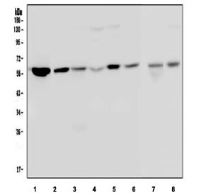 Anti-Optineurin / OPTN, clone 3D8
