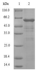 PDZ and LIM domain protein 1 (PDLIM1), human, recombinant