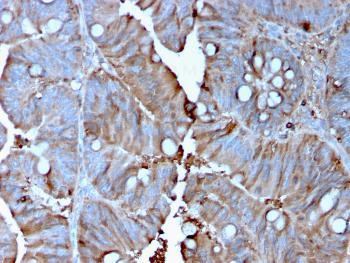Anti-MerTK (Innate Immune Checkpoint) Monoclona Antibody (Clone: MERTK/3015)