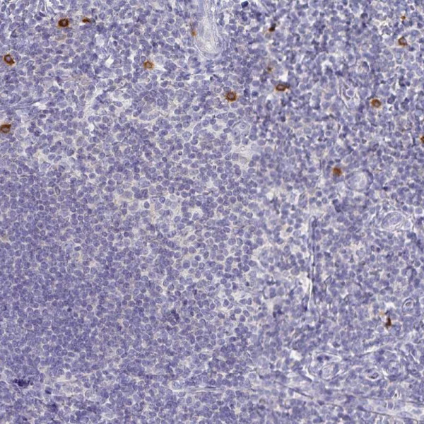 Anti-TNIP1