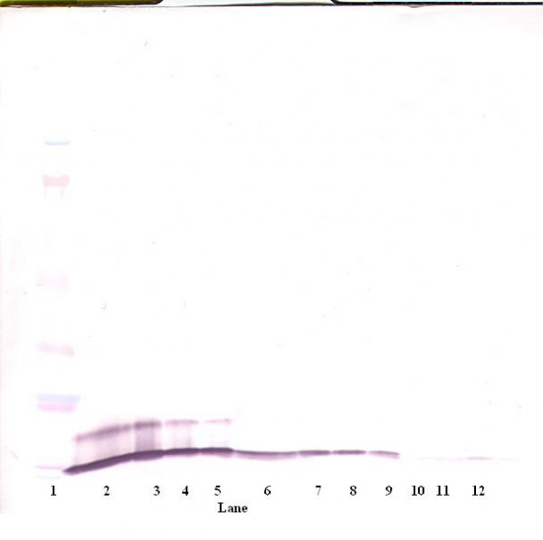 Anti-Cxcl1
