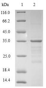 Non-histone chromosomal protein HMG-17 (HMGN2), human, recombinant