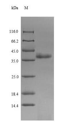Apoptin (VP3), Chicken anemia virus, recombinant