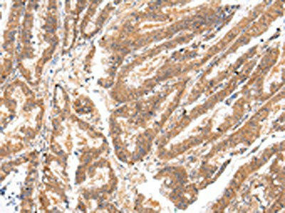 Anti-ATP7B