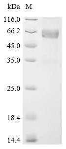 Sclerostin domain-containing protein 1 (SOSTDC1), recombinant human