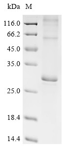 E3 ubiquitin-protein ligase MARCH5 (Marchf5), mouse, recombinant
