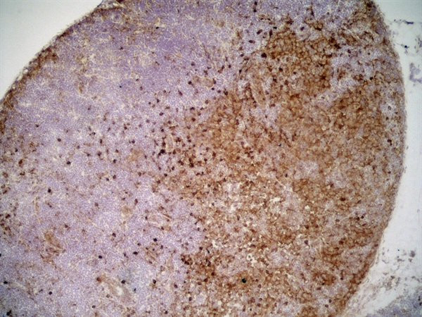 Anti-Monocyte + Granulocyte, clone ED9
