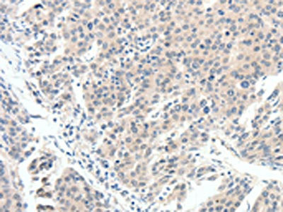 Anti-SCN10A