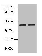 Anti-B4GALT3