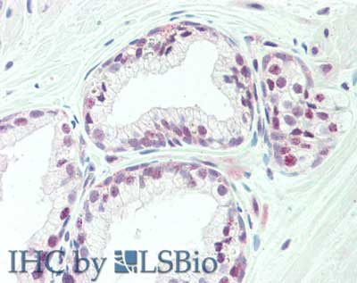 Anti-Transcription Initiation Factor TFIID Subunit 1 (TAF1)