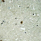 Anti-Phospho-HIRA (T555)