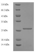 Killer cell immunoglobulin-like receptor 2DS1 (KIR2DS1), partial, human, recombinant