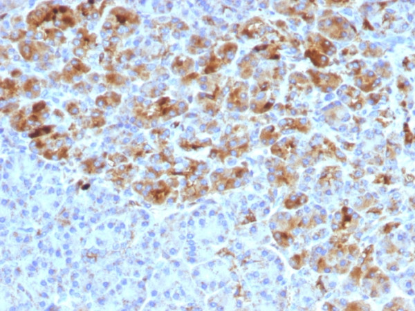 Anti-Alpha-1-Antichymotrypsin (SERPINA3) (Histiocytoma Marker), clone AACT/1452