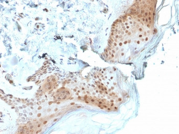 Anti-OGG1, clone CPTC-OGG1-1