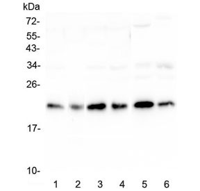 Anti-RKIP / PEBP1 / PBP