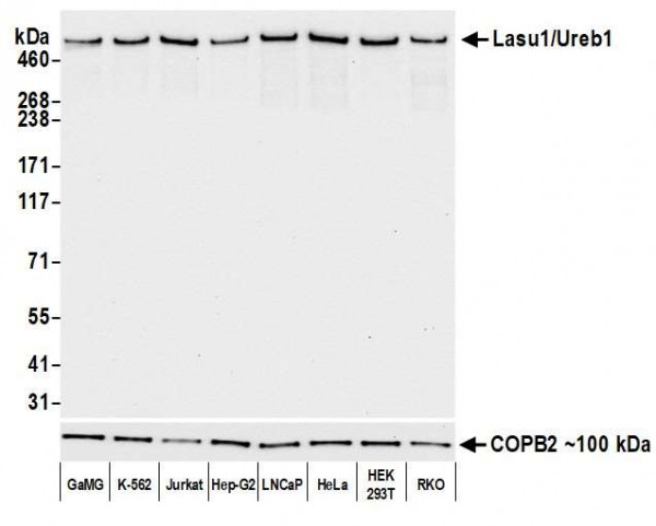 Anti-Lasu1/Ureb1 Recombinant Monoclonal