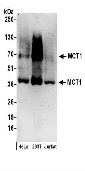 Anti-MCT1