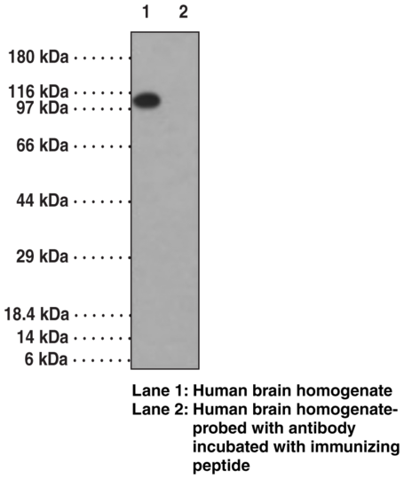 Anti-LSD1 (aa 100-150)