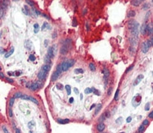 Anti-APOA1