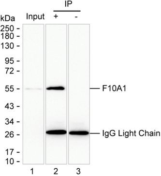 Anti-Hsc70 Interacting Protein HIP