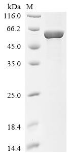 T cell receptor beta constant 1 (TRBC1), partial, Biotinylated, human, recombinant
