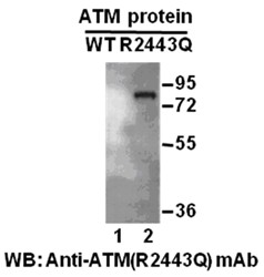 Anti-ATM (R2443Q)