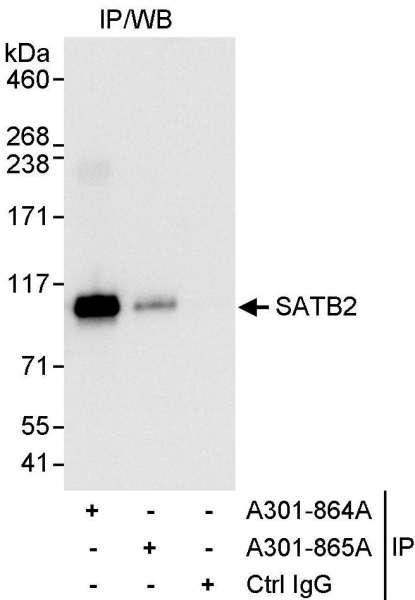 Anti-SATB2