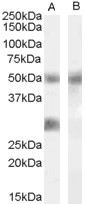 Anti-IGFBP3, Internal